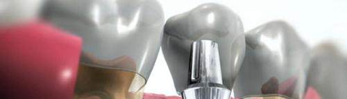 ARTIDENT, ZOBOZDRAVSTVENE STORITVE, LJUBLJANA