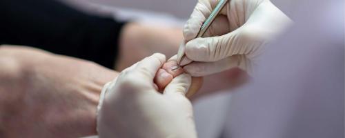 PEDIKURA REFLEKSNA MASAŽA STOPAL SLOVENJ GRADEC UROŠ BELINA